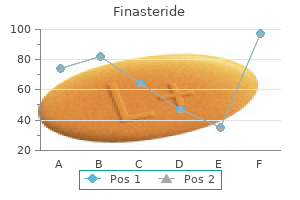 order generic finasteride on line