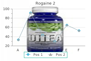 rogaine 2 60ml fast delivery